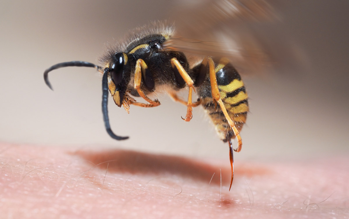 are wasp stings dangerous